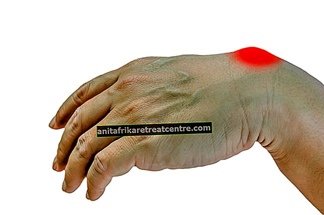 Ci sono sintomi di cisti della mano (ganglio)? Qual è il metodo di trattamento per la cisti della mano?
