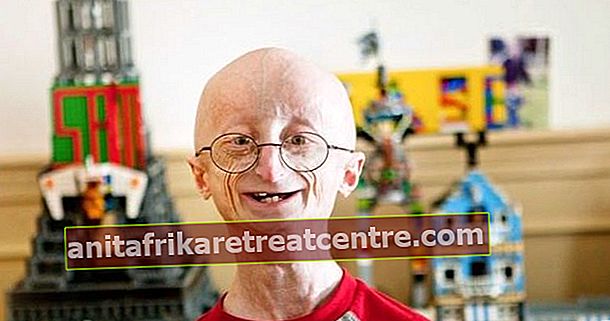 Cos'è la Progeria? Cause dell'invecchiamento precoce?
