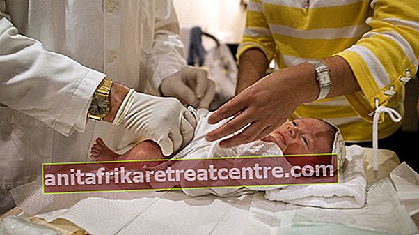 Quali sono i vantaggi della circoncisione?