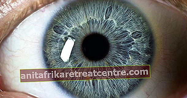 Presta attenzione alla malattia della pupilla