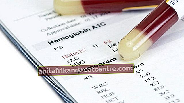 Apa itu hemogram? Bagaimana ujian hemogram dilakukan? Inilah maklumatnya